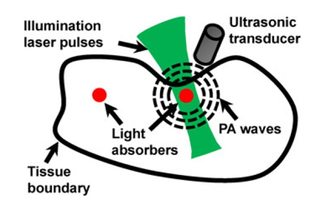 Photoacoustic 